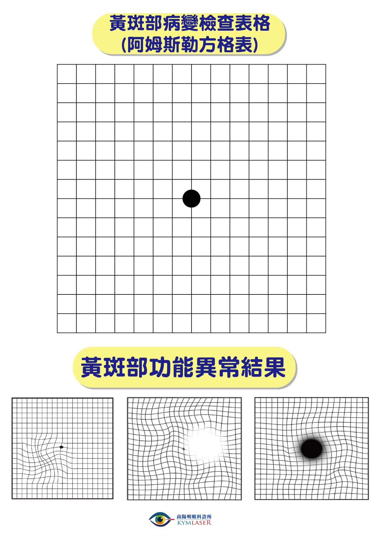 黃斑部病變檢查表格（阿姆斯勒方格表）與黃斑部功能異常結果