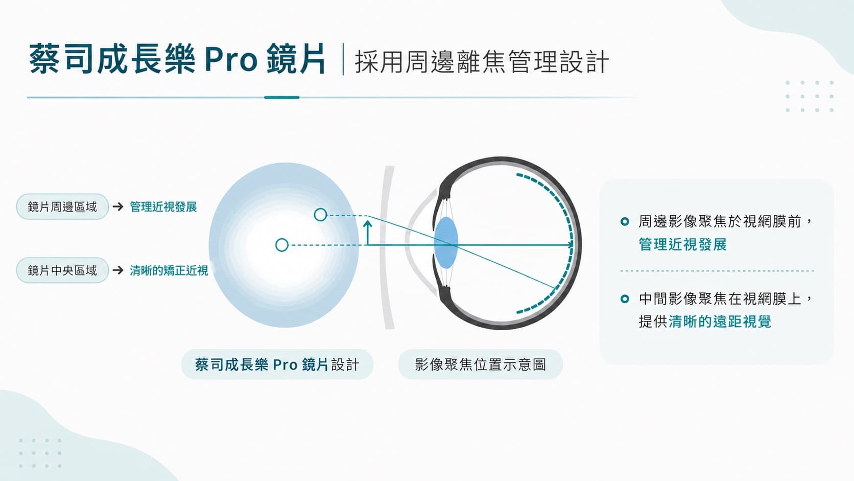 蔡司成長樂PRO鏡片周邊離焦管理設計示意圖－高陽明眼科