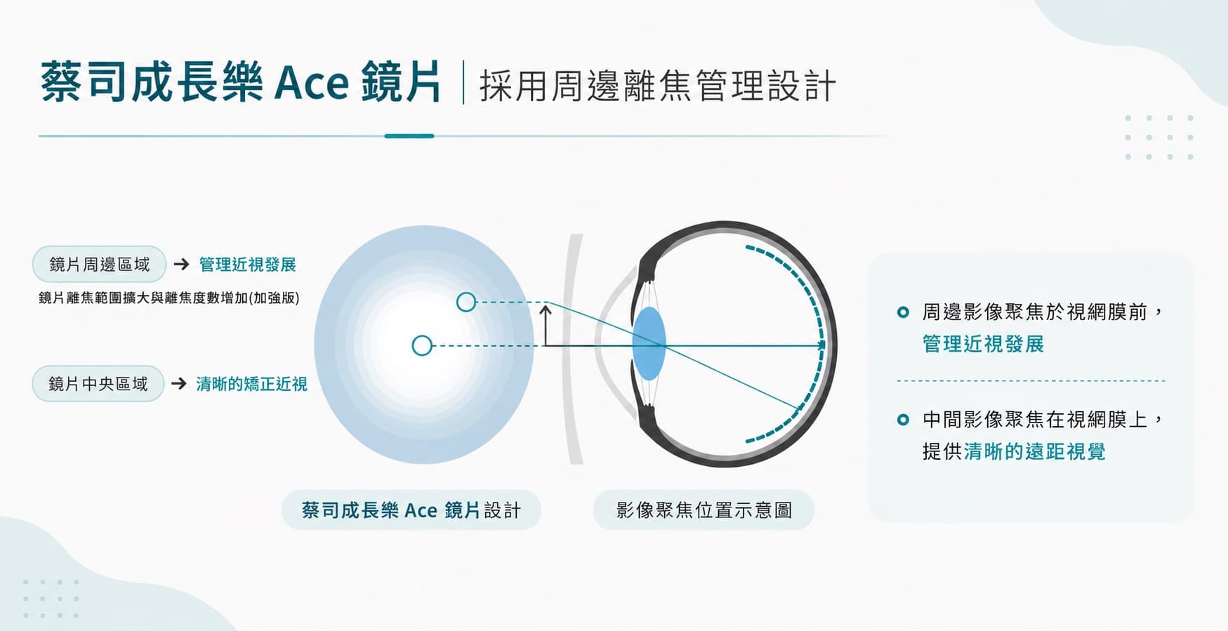 蔡司成長樂ACE鏡片加強版周邊離焦設計示意圖－高陽明眼科