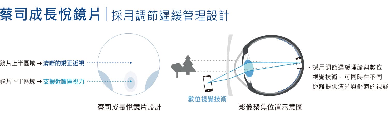 蔡司成長悅鏡片調節遲緩管理設計示意圖-高陽明眼科