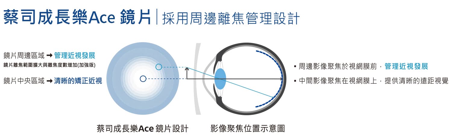 蔡司成長樂ACE鏡片加強版周邊離焦設計示意圖-高陽明眼科