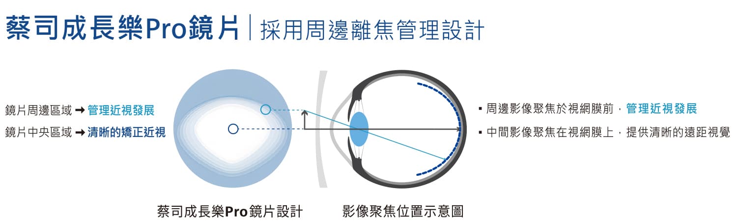 蔡司成長樂PRO鏡片周邊離焦管理設計示意圖-高陽明眼科