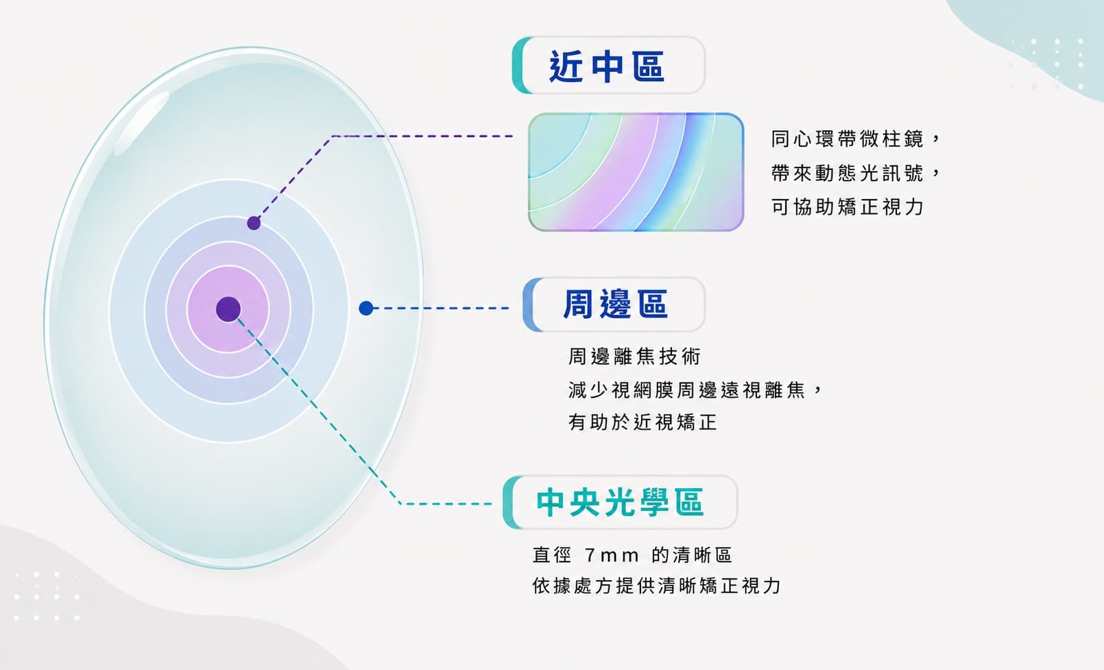 蔡司成長益鏡片中央光學區與周邊功能區示意圖－高陽明眼科