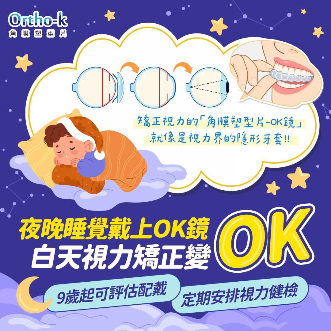 角膜塑型片作用原理示意圖:夜晚睡覺戴上OK鏡,暫時改變角膜形狀,白天視力矯正變清晰,如同視力界的隱形牙套|高陽明眼科診所